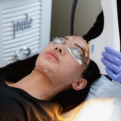 Picture of BBL / IPL Laser Technology Training Course