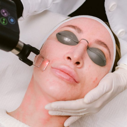Picture of CO₂ Fractional Laser Technology Training Course